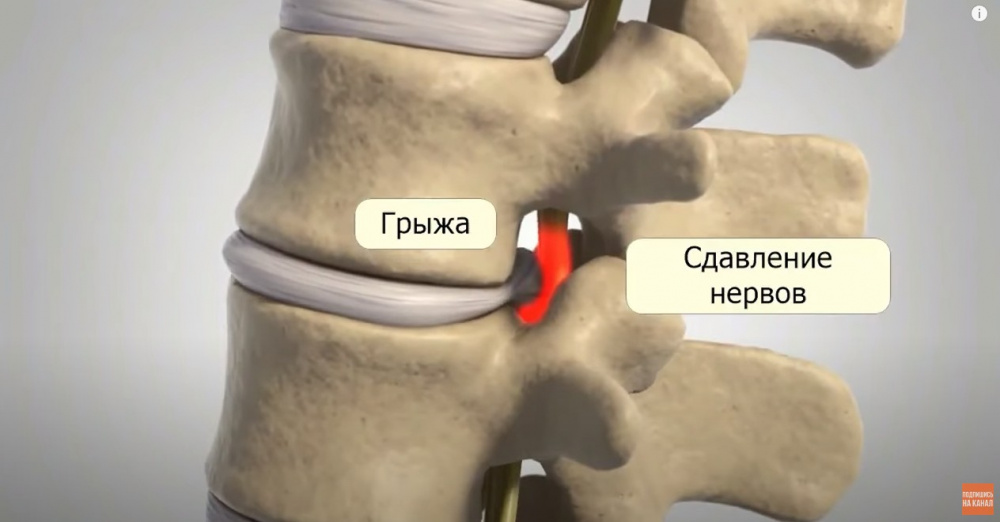 Как НЕ НУЖНО плавать, если болит спина, шея или суставы